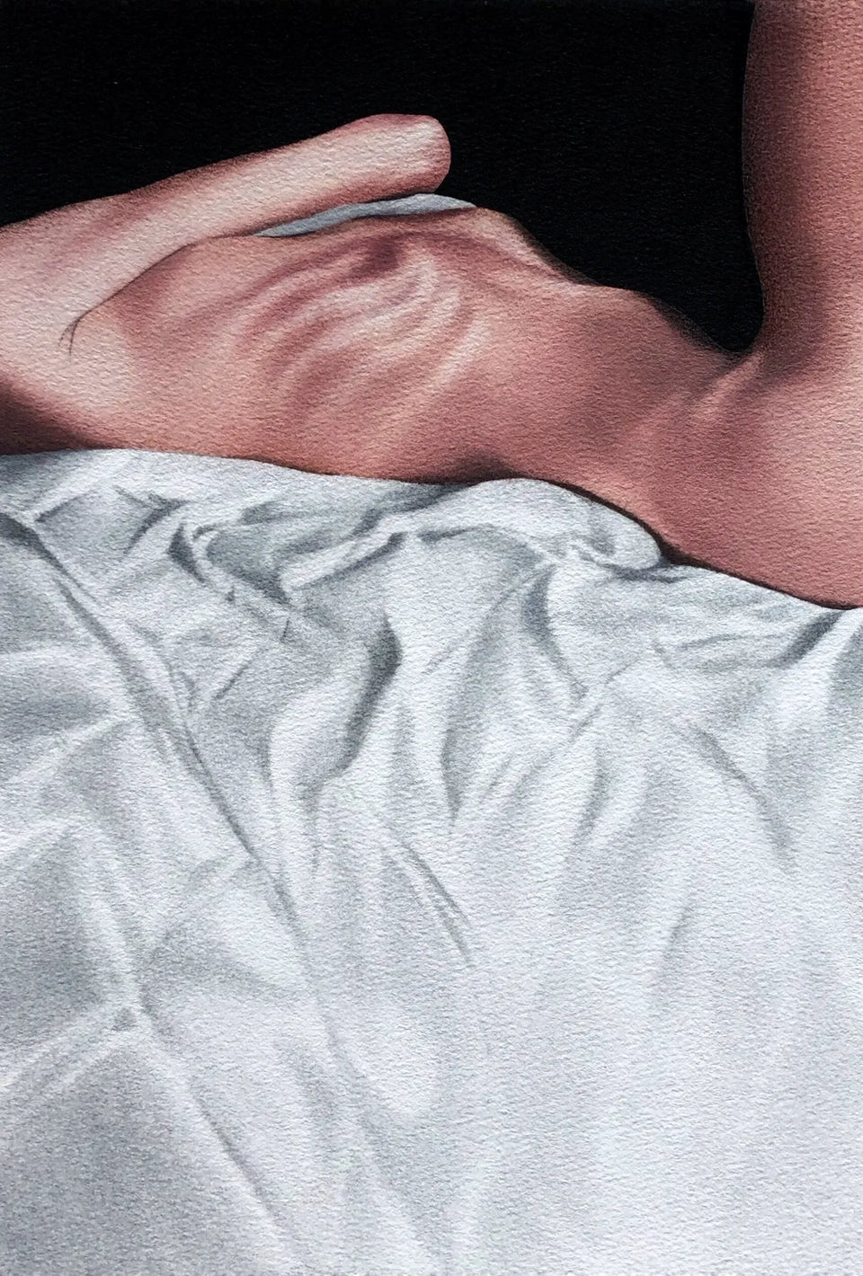 Bulimia